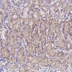 SPIRE2 Antibody, Novus Biologicals 25ul | Buy Online | Novus Biologicals | Fisher Scientific